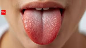 Tongue